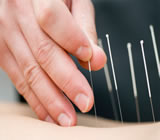 acupuntura-no-Itapetininga